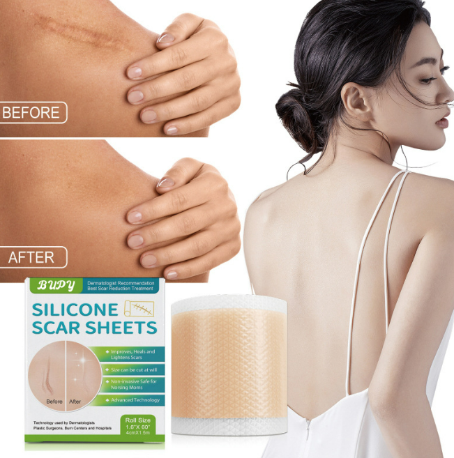 MC08114 BUPY Silicone Scar Sheets